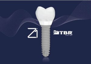 TBR Z1 Impianto dentale